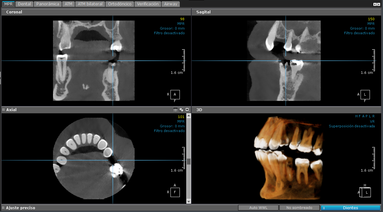 3D - Pieza Espec¡fica