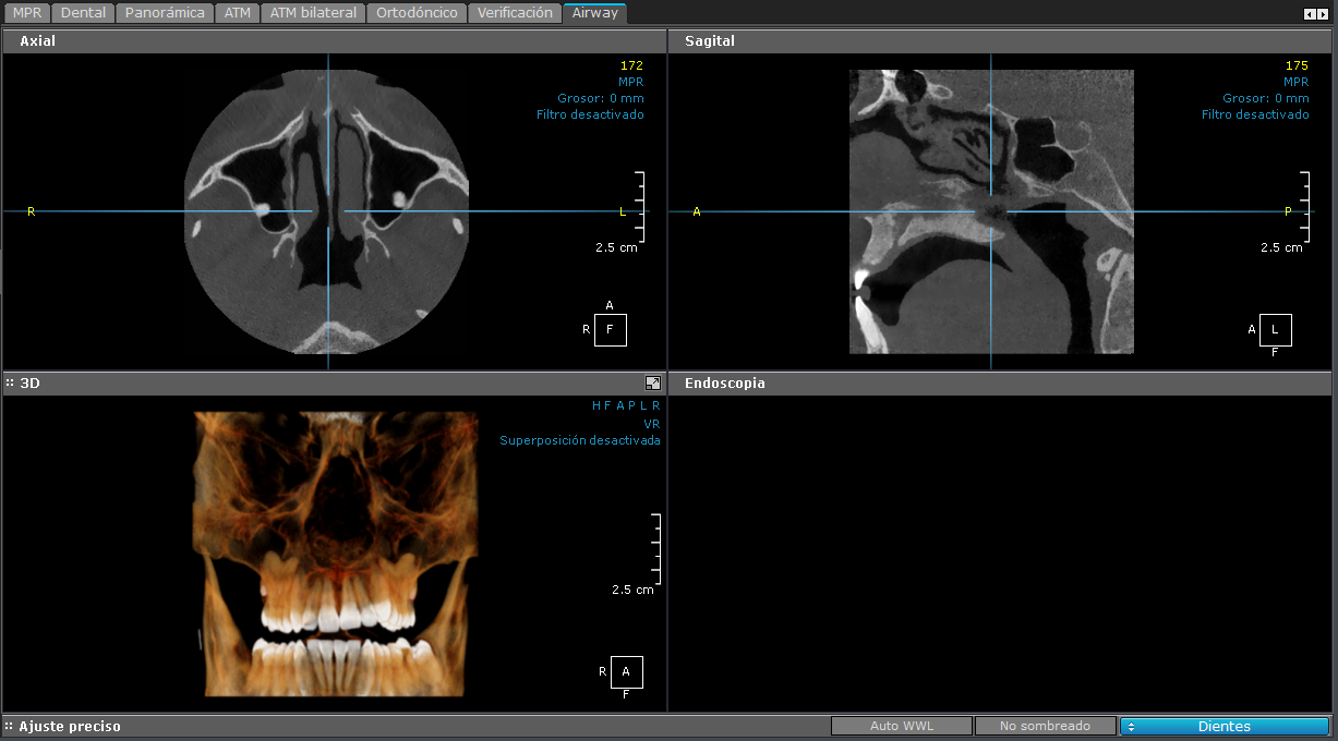 Oto - Senos Paranasales