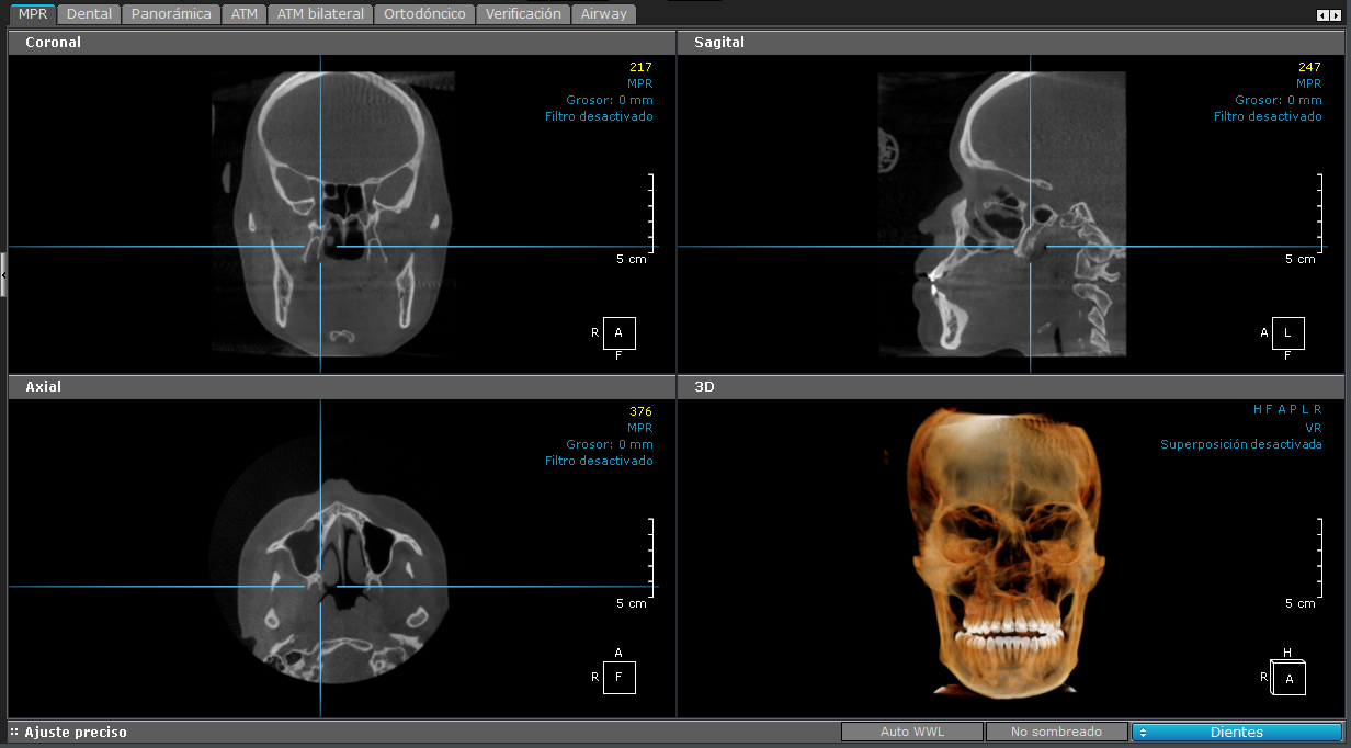 Oto - V¡as A‚reas