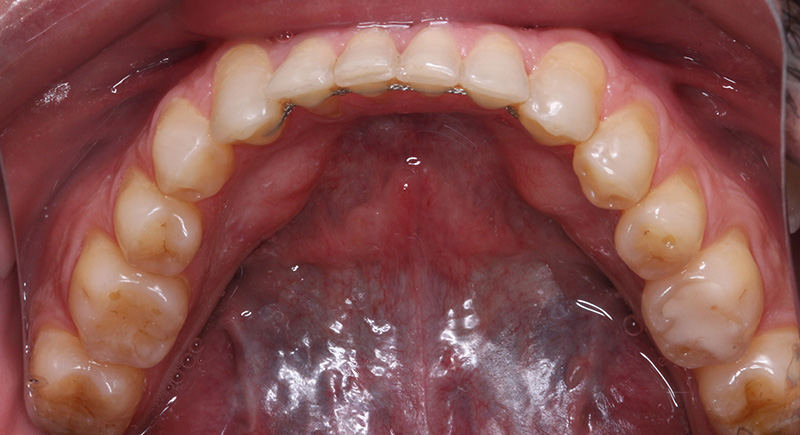 Intraoral-imagen-dental