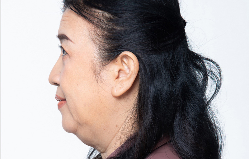 extraoral-imagen-dental