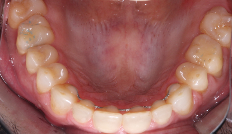 fotografia-Intraoral