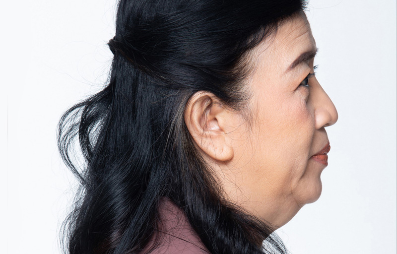 imagenes-extraorales